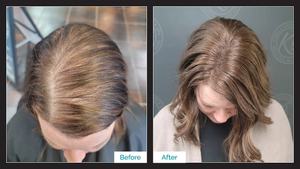 Wigs for Instant Hair Transformations – Change Styles Without Chemicals 20 k bella client before and after topper by kristan sayers.1200x0.jpg