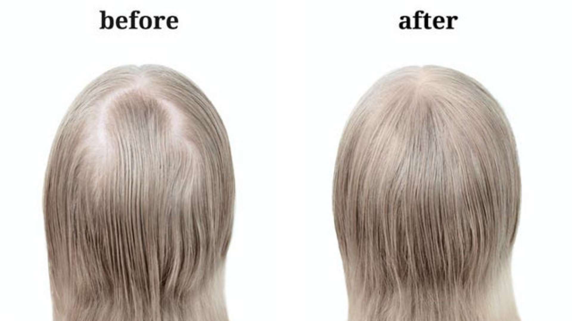 Top Wig Trends You’ll See Everywhere This Year 8 Natural Density Over Extra Volume